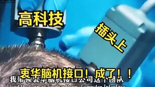 927d6b61037ceb34bdca3e27a0201c5103128857.jpg@308w_174h.jpeg