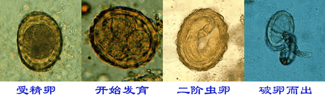 v2-930bdf8a2b8b139716e34853f52a7e48_720w.png
